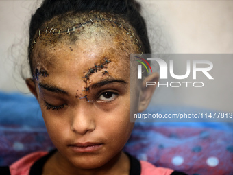 The Palestinian child Sila Houso, 7 years old, is being displaced from Gaza City to the central Gaza Strip. She is being injured during an I...