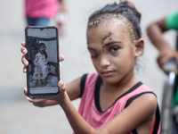 The Palestinian child Sila Houso, 7 years old, is being displaced from Gaza City to the central Gaza Strip. She is being injured during an I...