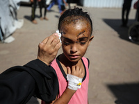 The Palestinian child Sila Houso, 7 years old, is being displaced from Gaza City to the central Gaza Strip. She is being injured during an I...