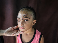 The Palestinian child Sila Houso, 7 years old, is being displaced from Gaza City to the central Gaza Strip. She is being injured during an I...