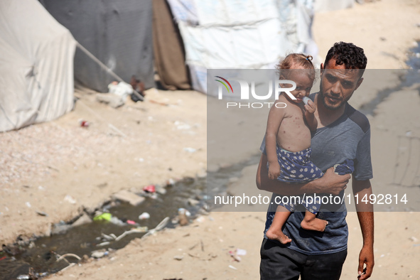 A displaced Palestinian father is carrying his son, who is suffering from a skin rash, while standing next to a pool of sewage water on the...