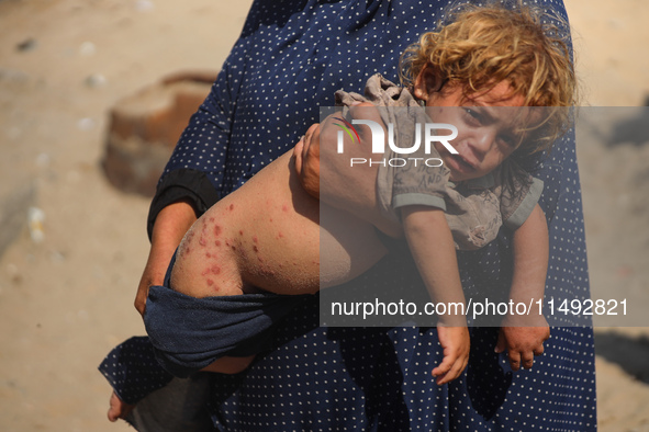 A displaced Palestinian mother is carrying her son, who is suffering from a skin rash, while standing next to a pool of sewage water on the...