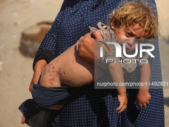 A displaced Palestinian mother is carrying her son, who is suffering from a skin rash, while standing next to a pool of sewage water on the...