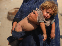 A displaced Palestinian mother is carrying her son, who is suffering from a skin rash, while standing next to a pool of sewage water on the...