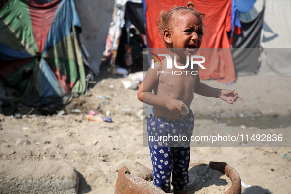 A Palestinian girl is suffering from a skin rash and is walking past a pool of sewage water on a street in Deir al-Balah in central Gaza Str...