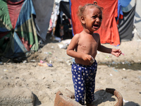 A Palestinian girl is suffering from a skin rash and is walking past a pool of sewage water on a street in Deir al-Balah in central Gaza Str...