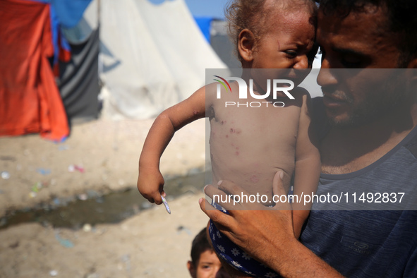 A displaced Palestinian father is carrying his son, who is suffering from a skin rash, while standing next to a pool of sewage water on the...