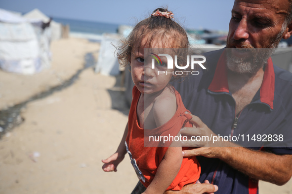 A displaced Palestinian father is carrying his son, who is suffering from a skin rash, while standing next to a pool of sewage water on the...