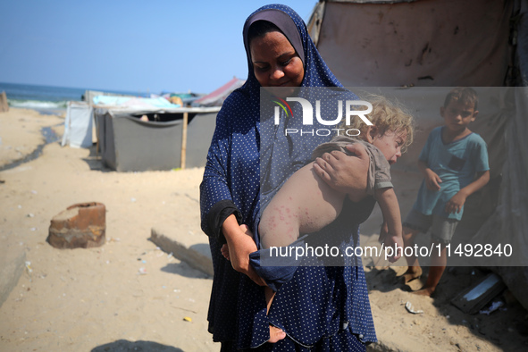 A displaced Palestinian mother is carrying her son, who is suffering from a skin rash, while standing next to a pool of sewage water on the...