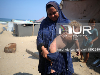 A displaced Palestinian mother is carrying her son, who is suffering from a skin rash, while standing next to a pool of sewage water on the...