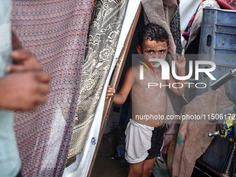 A Palestinian boy suffers from a skin rash at a makeshift camp for displaced Palestinians in Deir al-Balah, Gaza Strip, on August 24, 2024,...