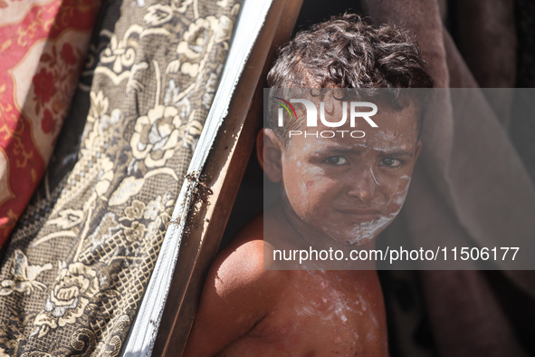 A Palestinian boy suffers from a skin rash at a makeshift camp for displaced Palestinians in Deir al-Balah, Gaza Strip, on August 24, 2024,...