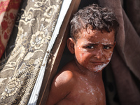 A Palestinian boy suffers from a skin rash at a makeshift camp for displaced Palestinians in Deir al-Balah, Gaza Strip, on August 24, 2024,...