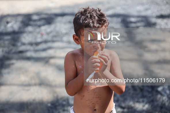 A Palestinian boy suffers from a skin rash at a makeshift camp for displaced Palestinians in Deir al-Balah, Gaza Strip, on August 24, 2024,...