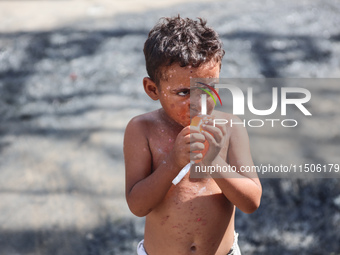 A Palestinian boy suffers from a skin rash at a makeshift camp for displaced Palestinians in Deir al-Balah, Gaza Strip, on August 24, 2024,...