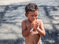 A Palestinian boy suffers from a skin rash at a makeshift camp for displaced Palestinians in Deir al-Balah, Gaza Strip, on August 24, 2024,...