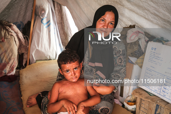 A woman holds a child suffering from a rash at a makeshift camp for displaced Palestinians in Deir al-Balah in the central Gaza Strip on Aug...