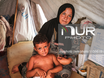 A woman holds a child suffering from a rash at a makeshift camp for displaced Palestinians in Deir al-Balah in the central Gaza Strip on Aug...