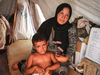 A woman holds a child suffering from a rash at a makeshift camp for displaced Palestinians in Deir al-Balah in the central Gaza Strip on Aug...