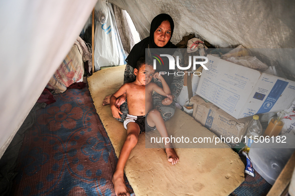 A woman holds a child suffering from a rash at a makeshift camp for displaced Palestinians in Deir al-Balah in the central Gaza Strip on Aug...