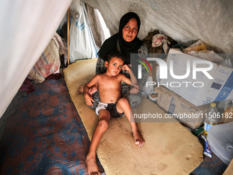 A woman holds a child suffering from a rash at a makeshift camp for displaced Palestinians in Deir al-Balah in the central Gaza Strip on Aug...