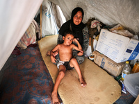 A woman holds a child suffering from a rash at a makeshift camp for displaced Palestinians in Deir al-Balah in the central Gaza Strip on Aug...