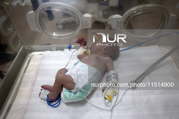 A Palestinian premature baby receives care in an incubator during preparations to evacuate the Al-Aqsa Martyrs Hospital in Deir al-Balah in...