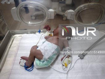 A Palestinian premature baby receives care in an incubator during preparations to evacuate the Al-Aqsa Martyrs Hospital in Deir al-Balah in...