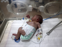 A Palestinian premature baby receives care in an incubator during preparations to evacuate the Al-Aqsa Martyrs Hospital in Deir al-Balah in...