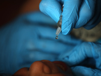 A Palestinian child receives a polio vaccination at a United Nations healthcare center in Deir Al-Balah in the central Gaza Strip, on Septem...