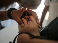 A Palestinian child receives a polio vaccination in the UK-MED field hospital in Zawayda, Gaza Strip, on September 2, 2024, amid the ongoing...