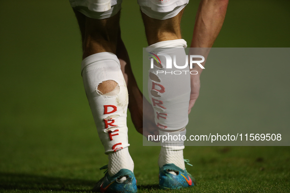 Holes are cut into the socks of Doncaster Rovers's Jamie Sterry during the Sky Bet League 2 match between Harrogate Town and Doncaster Rover...