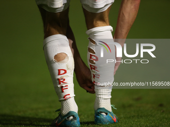 Holes are cut into the socks of Doncaster Rovers's Jamie Sterry during the Sky Bet League 2 match between Harrogate Town and Doncaster Rover...