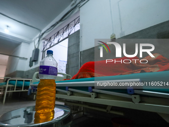 A dengue-infected patient undergoes treatment at Sukraraj Tropical and Infectious Disease Hospital in Kathmandu, Nepal, on September 24, 202...