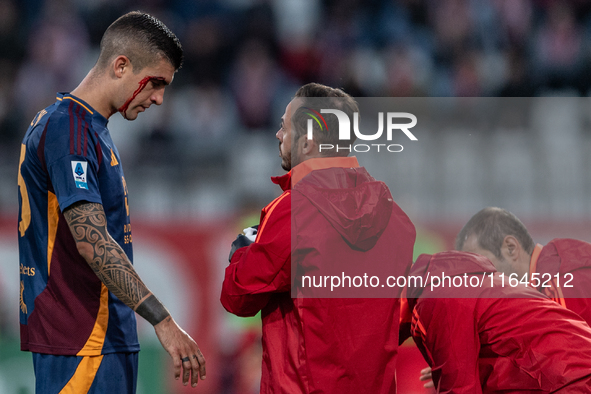 Gianluca Mancini of AS Roma is injured during the Serie A match between Monza and AS Roma at U-Power Stadium in Monza, Italy, on October 6,...