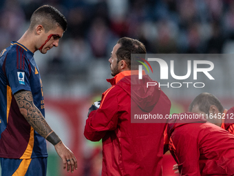 Gianluca Mancini of AS Roma is injured during the Serie A match between Monza and AS Roma at U-Power Stadium in Monza, Italy, on October 6,...