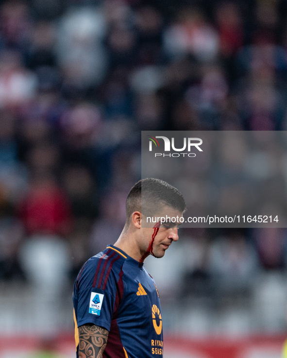 Gianluca Mancini of AS Roma is injured during the Serie A match between Monza and AS Roma at U-Power Stadium in Monza, Italy, on October 6,...