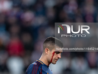 Gianluca Mancini of AS Roma is injured during the Serie A match between Monza and AS Roma at U-Power Stadium in Monza, Italy, on October 6,...