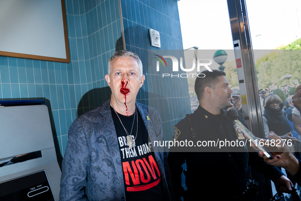 A bloodied Todd Richman stands after clashes break out where his Israeli flag is taken from him and a tambourine is thrown into his face as...