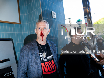 A bloodied Todd Richman stands after clashes break out where his Israeli flag is taken from him and a tambourine is thrown into his face as...