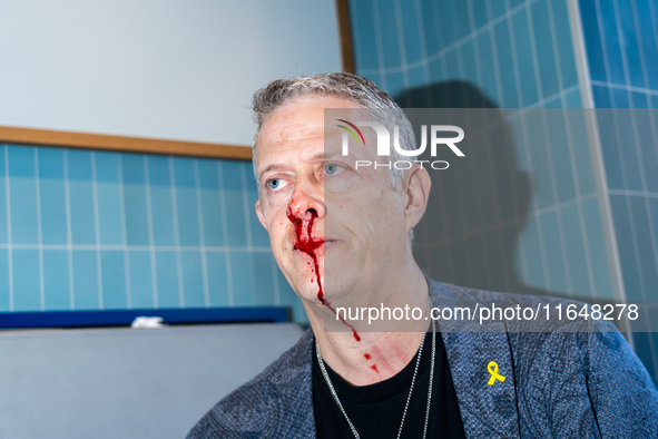 A bloodied Todd Richman stands after clashes break out where his Israeli flag is taken from him and a tambourine is thrown into his face as...