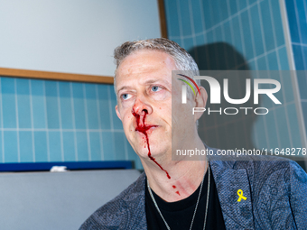 A bloodied Todd Richman stands after clashes break out where his Israeli flag is taken from him and a tambourine is thrown into his face as...