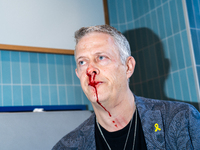 A bloodied Todd Richman stands after clashes break out where his Israeli flag is taken from him and a tambourine is thrown into his face as...