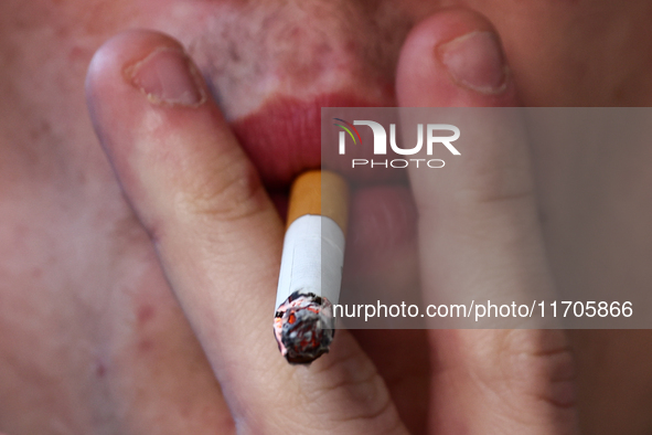 A person smokes a cigarette in Krakow, Poland on October 25, 2024. 