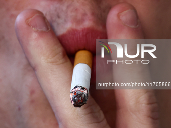 A person smokes a cigarette in Krakow, Poland on October 25, 2024. (