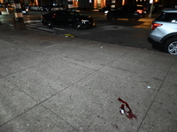 A young teenage girl is stabbed in the Melrose section of Bronx, New York, United States, on November 18, 2024. At approximately 2:55 PM, in...