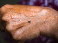 A Banded Phintella (Phintella vittata), also known as the Electric Blue Jumper, is seen climbing on a human hand adorned with a shakha (whit...