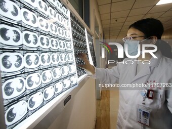 A doctor examines a CT image in Handan, Hebei province, China, on January 1, 2022. (