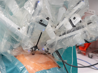 Bariatric surgery for an overweight patient performed using the Da Vinci medical robot at the Military Institute of Medicine  in Warsaw, Pol...