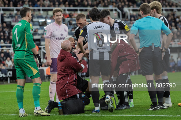 Newcastle United's Joelinton receives treatment for a facial wound during the Carabao Cup Quarter Final match between Newcastle United and B...